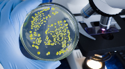 chpl news Proces uodparniania się drobnoustrojów na antybiotyki przyspiesza