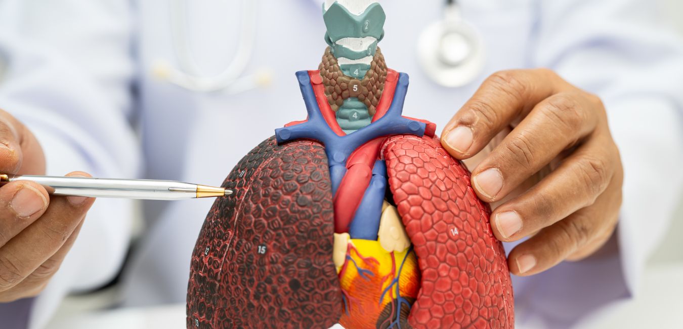 Czy obecne kryteria screeningu raka płuca wykluczają 2/3 pacjentów?